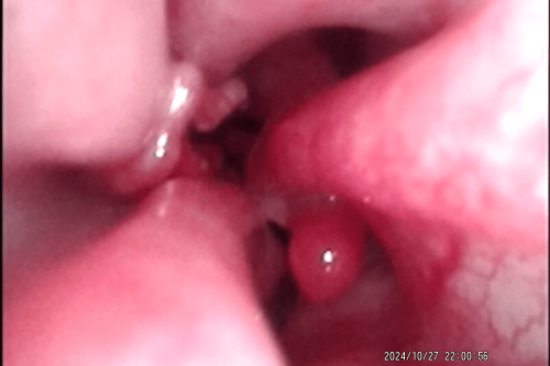 cavidade nasal normal cão