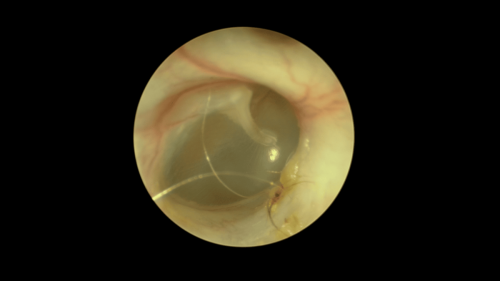 membrana-timpanica-D-felino